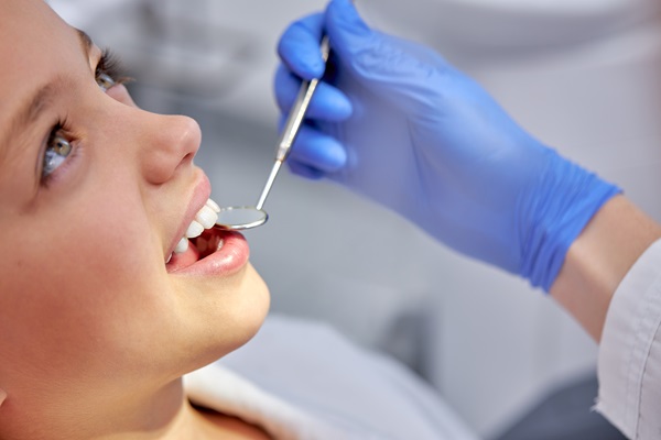 How Dental Sealants Protects Against Cavities