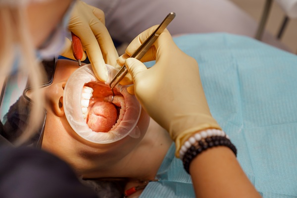 The Difference Between Simple And Surgical Tooth Extraction